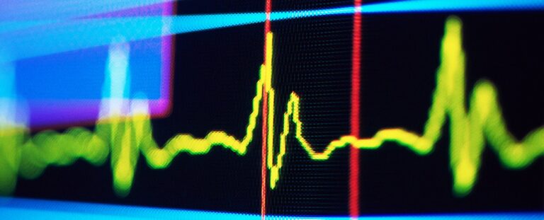 Технології - Ритм у пульсі людини може сигналізувати про майбутнє когнітивне погіршення