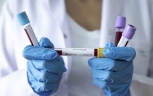 Новини України - В Україні утричі зросла кількість випадків COVID за тиждень